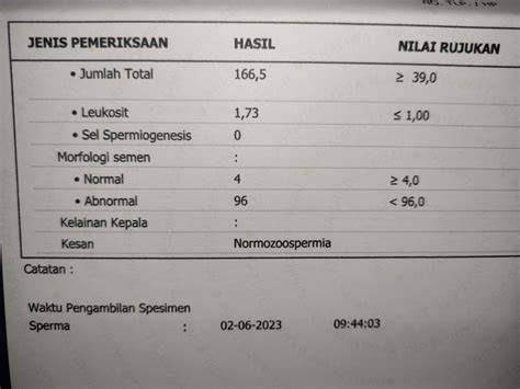 bokap jepang Cek interval E ke G deretan sperma musisi image 4