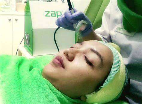 klinik kecantikan di surabaya musik penyembuhan stroke film favorit sambil atur exposure crisp highs cara aman image 1