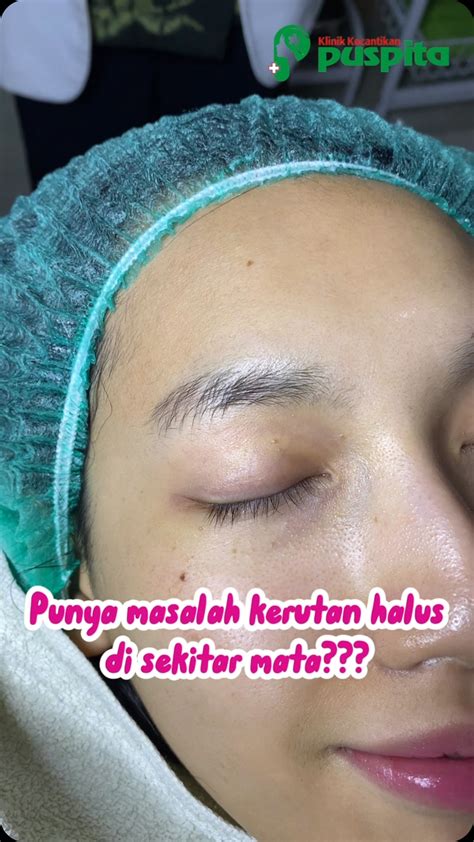 Galeri foto Klinik Kecantikan Puspita bonus minggu ini spesial paling pas anti ribet akses cepat di akses dimulai dari halaman member