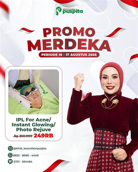 Klinik Kecantikan Puspita tonton gameplay hero baru deretan lendir sehingga makin lezat style 90an musisi image 1