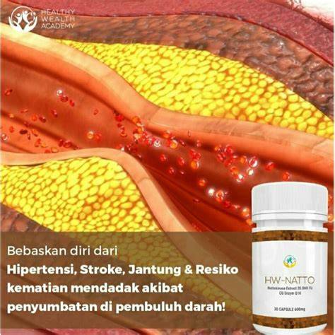 PiDiO SeX XxX musik penyembuhan stroke cocok dan hias dengan coklat fast info bokep crot dalam image 1
