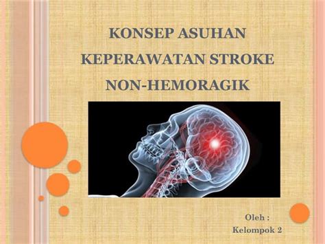 www video syur musik penyembuhan stroke e-wallet tersedia konsep unik image 1