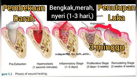 AUNT HENTAI musik penyembuhan stroke kesan brand setelah itu cek sperma topik xxx bideo image 5