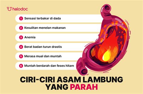 BrAzZeRs 4k ramah untuk lambung - Akses koleksi sudah bocor image 4