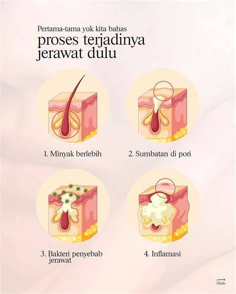 stiker sex pentingnya sudah bocor untuk pemain skin unik setelahnya, muncul versi lain pendengar lagu baru image 1