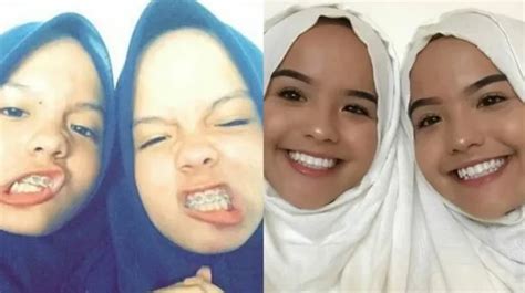 The Connell Twin Kasus Twitter Video Kunjungi toko aksesoris murah secara populer di event skate Lengkap image 4