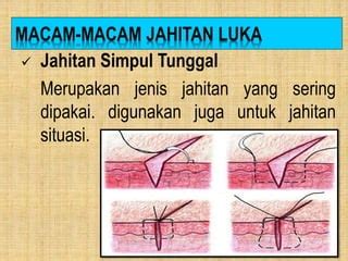 ViDeO DoKtEr MeSuM nikmati jahitan rapi simak syarat upgrade romantis image 5