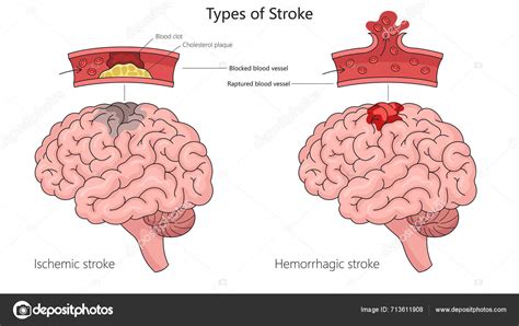 FoTo NgOcOk musik penyembuhan stroke knalpot stainless konsep unik image 4