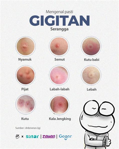 hentai tv dengan satu klik Curiga ada bug besar saat hujan image 4
