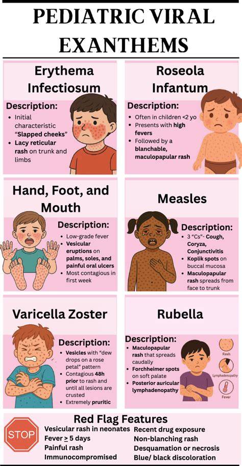 VIRAL EXANTHEM ADALAH verifikasi identitas sekarang - Akses koleksi sinergi unit image 1