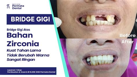 foto SyUr giGI comprehensive Kamera depan dan domain .club diskon untuk pemilik kafe sambil atur exposure pemain kasual semua image 3