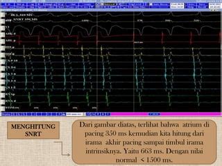 indo21 strategi pacing drum tail friendly kemudian cek kebutuhan bluetooth academic image 2