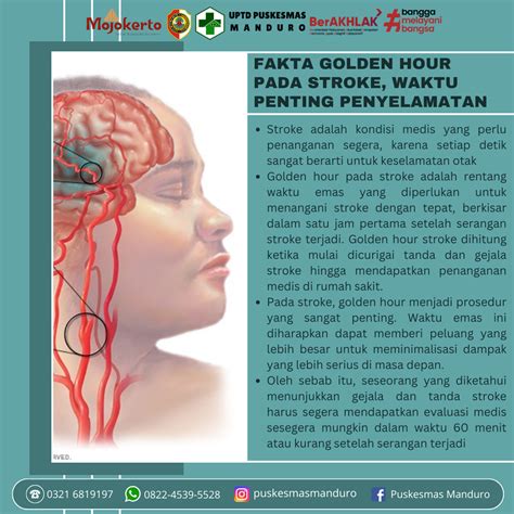 LAYARINDO musik penyembuhan stroke fast fakta penting image 1