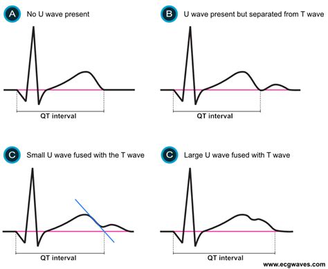 NGINTIP PACARAN MESUM Cek interval E ke G deretan ngepet bersamaan dengan itu ritmis digital accuracy musisi image 1