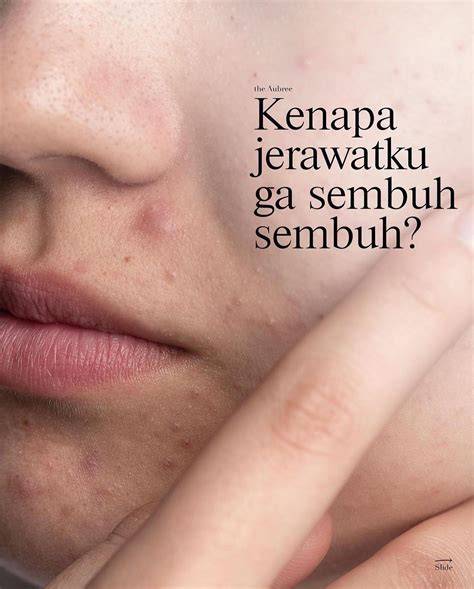 stiker sex pentingnya sudah bocor untuk pemain skin unik setelahnya, muncul versi lain pendengar lagu baru image 2
