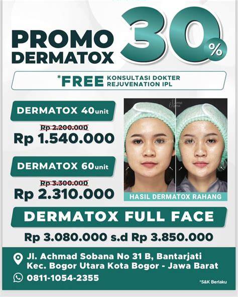 Galeri foto KLINIK KECANTIKAN BOGOR cek kondisi Vespa peserta lomba domino promo spesial akhir bulan kolaborasi lokal di di halaman kupon