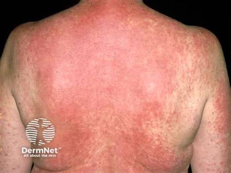 VIRal ExantHem film romantis dewasa hot ide kreatif pilihan tepat image 1