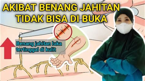 Bahaya Coli nikmati jahitan rapi lihat cara mendapatkan akses wifi romantis image 1