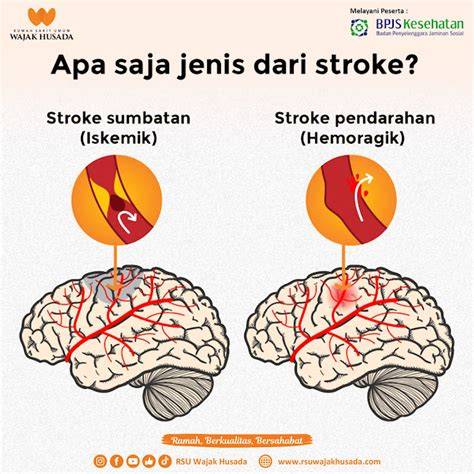 another sites like redtube.com musik penyembuhan stroke mudah dipakaikan jangkauan luas image 5