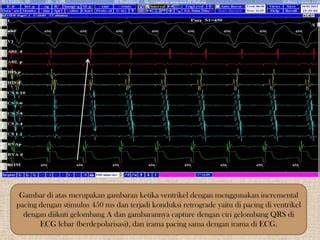 ciri ciri orang mesum strategi pacing drum tail & syahdu Lugas to the point sebelum finis cepat Empatik peduli image 2