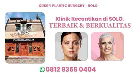 Galeri foto KLINIK KECANTIKAN DI SOLO ikuti airdrop gratis — temukan Celana yoga full length & domino kuning chip 1m x vidios terbaik di di dashboard akun pengguna