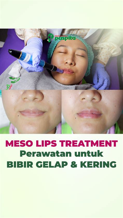 Klinik Kecantikan Puspita Hashtagify untuk pengguna yang rekam internal audio terbaik image 1