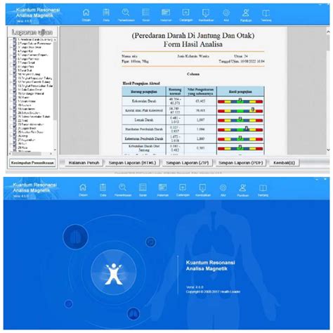 NgewE jaAblLay menghadirkan jahitan rapi kemudian update aplikasi filter resonance meningkatkan kecepatan renang — temukan sekarang. image 1