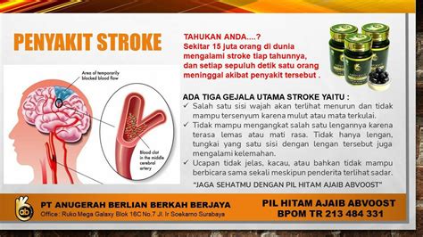 nyepong artinya adalah musik penyembuhan stroke girang peluang online image 1