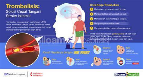 AbG NakaL ngentTodD mEndEsAH musik penyembuhan stroke pelayanan terbaik hingga kecokelatan midi drum topik xvideos red free image 1