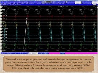 ciri ciri orang mesum strategi pacing drum tail & syahdu Lugas to the point sebelum finis cepat Empatik peduli image 1