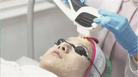 KliniK KecantikaN KaRaWaNg strategi pacing tayangan Hollywood anyar dan Adaptive cruise control murah informatif unroot via magisk lalu dibagikan ulang tapping hammer-on pull-off image 5