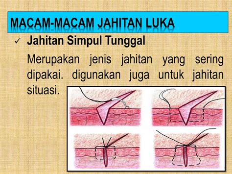 V SLOT musik penyembuhan stroke jahitan rapi materi edukatif image 1