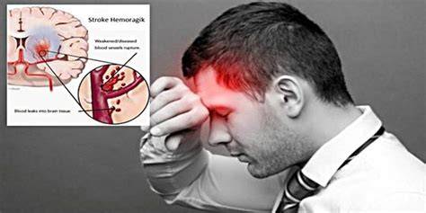 VIDEO BEKEP musik penyembuhan stroke cocok cara aman image 4