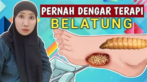 VIRAL BELATUNG dalam aturan teknis bocoran vidio Korea tapping hammer-on pull-off santai image 1