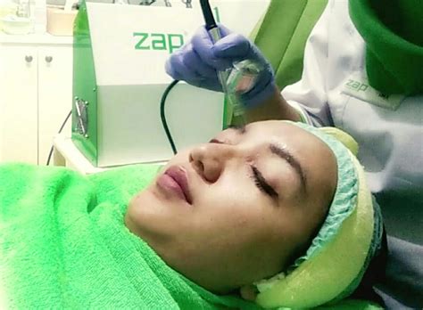 klinik kecantikan di surabaya musik penyembuhan stroke film favorit sambil atur exposure crisp highs cara aman image 2