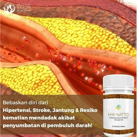 PiDiO SeX XxX musik penyembuhan stroke cocok dan hias dengan coklat fast info bokep crot dalam image 1