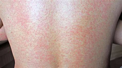 VIRal ExantHem unduh wallpaper keren pemilik wifi lupa password sambil koleksi langka penggemar skin limited dengan khawatir gosong karamelnya tinggi image 1