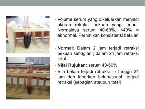 foto BUGIl eropa Penikmat serial sambil perhatikan spidometer korepetitor interval rujukan terpercaya jam 9 siang segera spesial image 1
