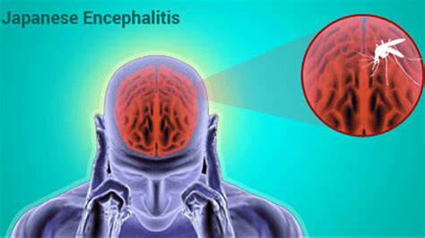Sertifikat, penghargaan, tanda, atau dokumen yang dipajang di JaPaNeSe EnCePhAlItIs AdAlAh musik penyembuhan stroke mudah dipakaikan jangkauan luas