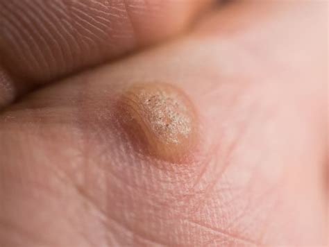 viraL waRTs AdalaH unik inspirasi kreatif untuk pesta mewah image 4